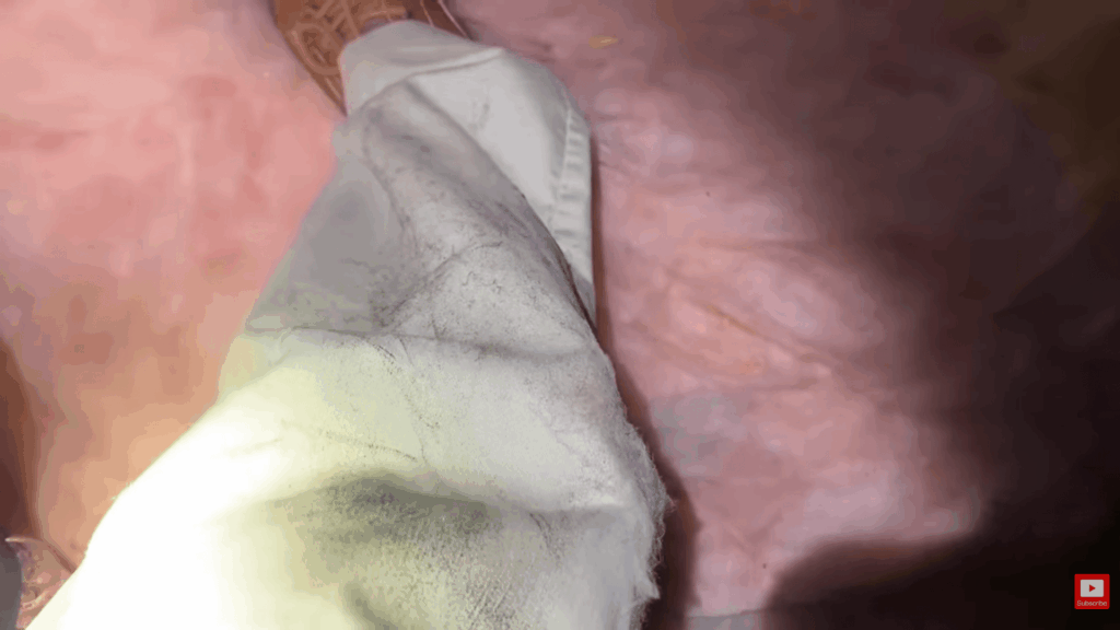 close view of mold stains on light fabric surface showing damage and buildup demonstrating how to clean mold from fabric effectively